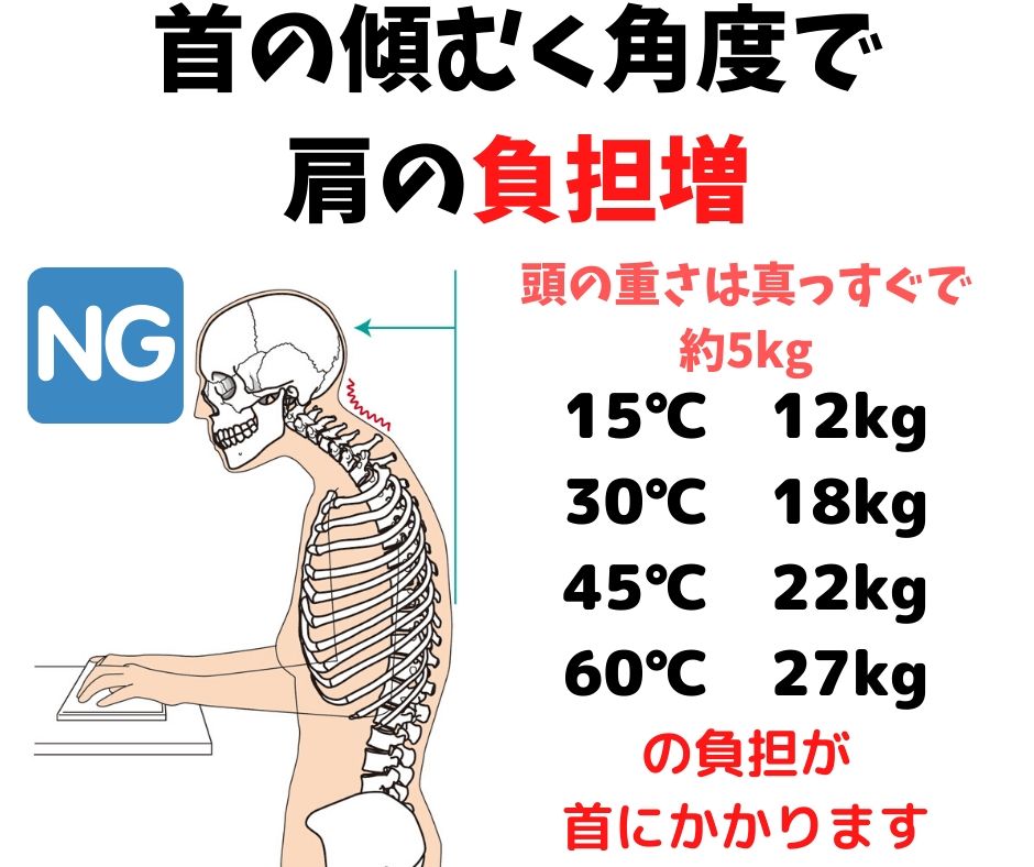 抗重力筋と不良姿勢のイメージ