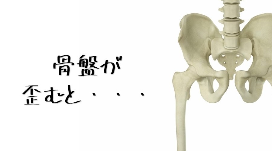 骨盤の歪みイメージ