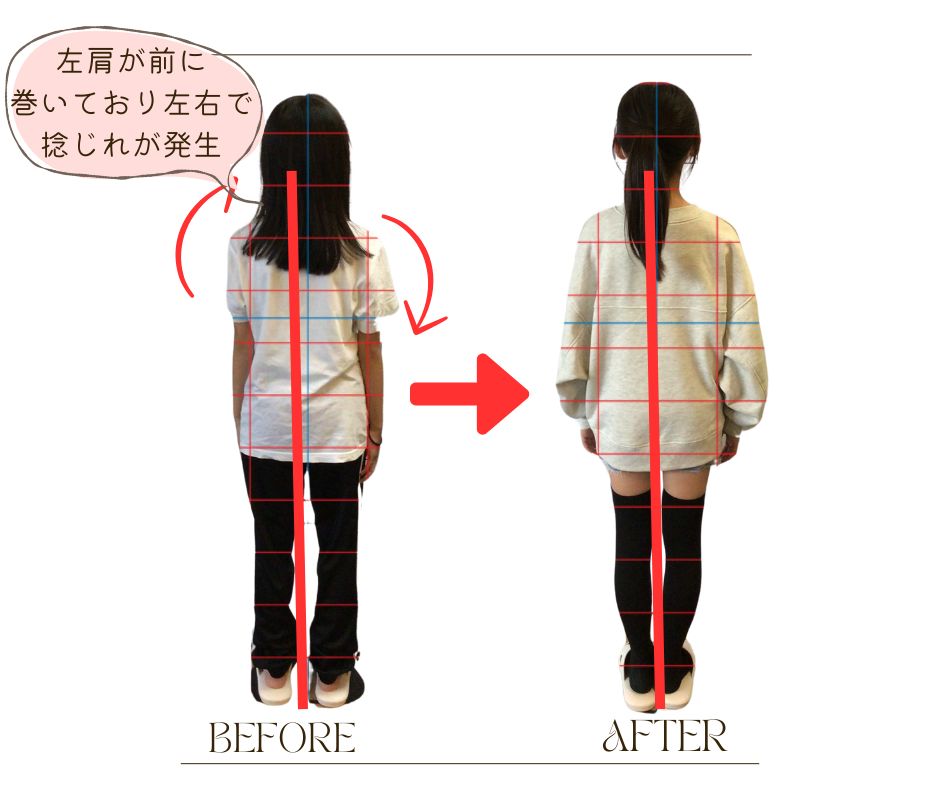 整体後 before-after 2