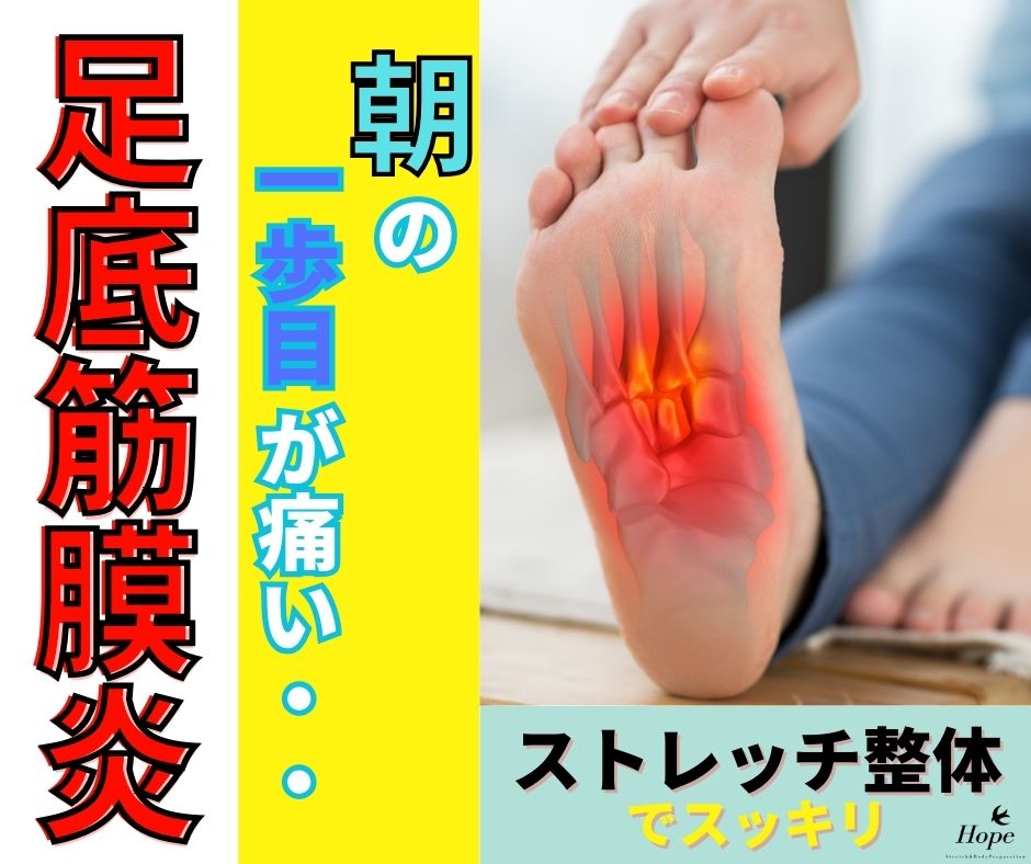 「朝の一歩目が激痛」なあなたへ。滋賀の整体が教える足底筋膜炎の正体と対策