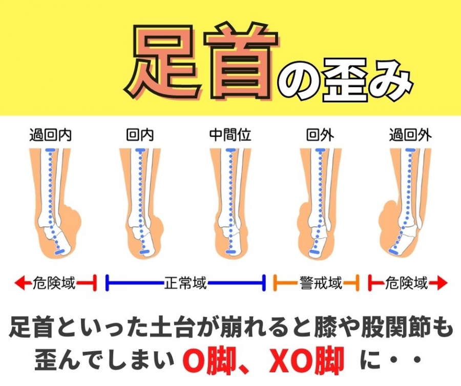 足首の歪みからO脚、XO脚になる可能性があります