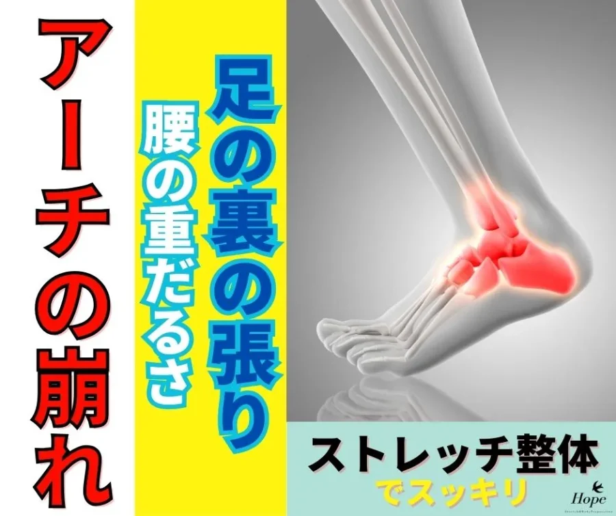 足の裏の張りや腰の重だるさでお悩みの方へ。滋賀の整体が教える「アーチの崩れ」と解決策
