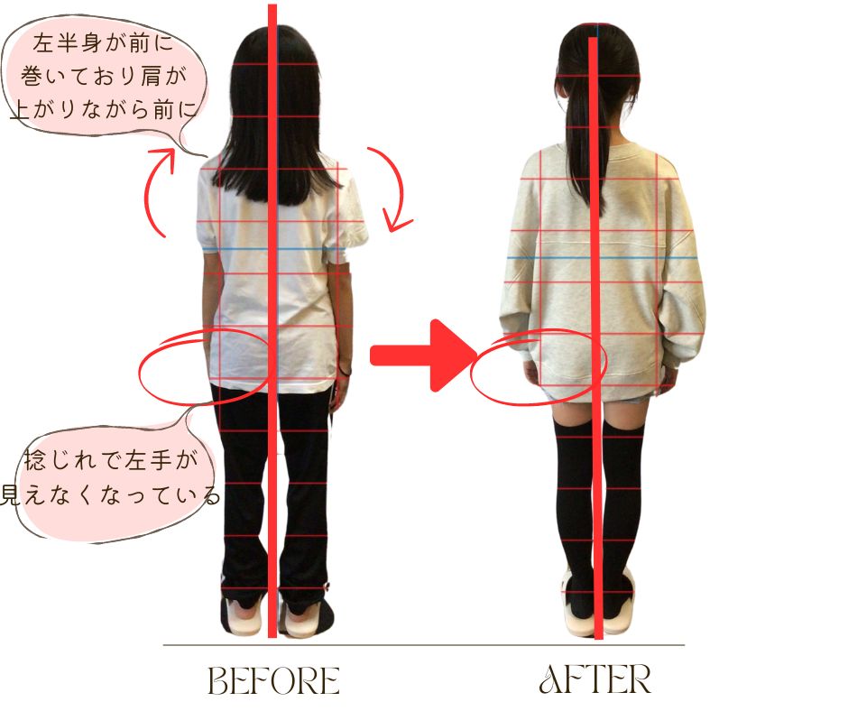 頭痛整体 歪みを整えて頭痛の回数を軽減
