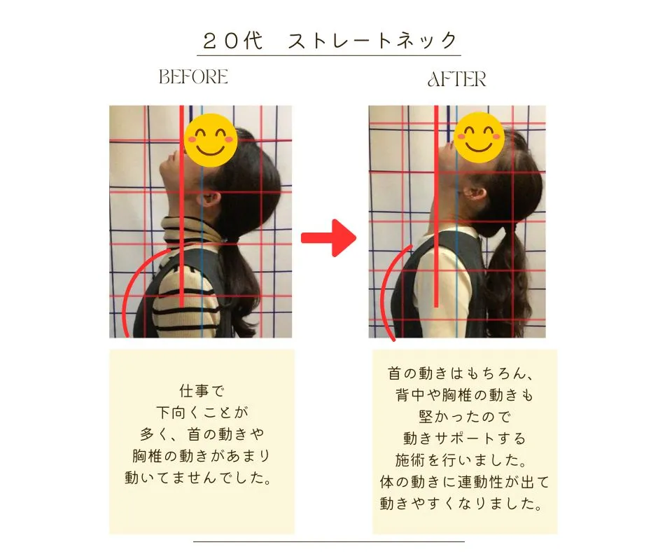 首・肩まわりのコンディショニングの様子1